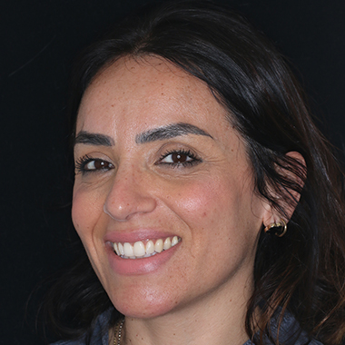 Assistente alla poltrona Angela Iannei